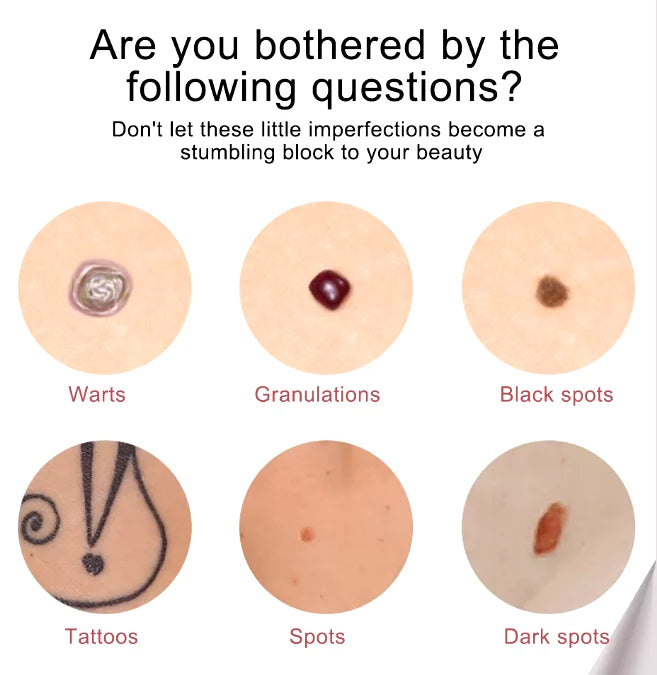 Pluma para Eliminar Lunares  Set of 3 - Unisex - Talla Única (One Size)