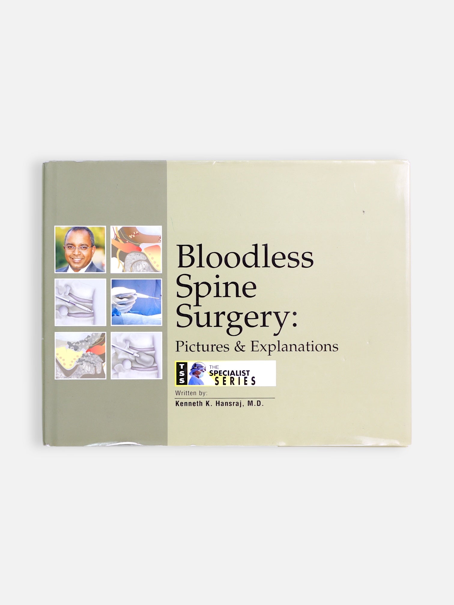Libro BLOODLESS SPINE SURGERY by Kennetk k. Hansraj, M.D